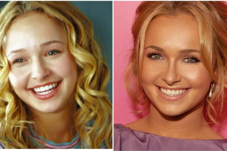 Penyebab Kematian Aktris Hayden Panettiere Terungkap, Diduga Karena Overdosis!