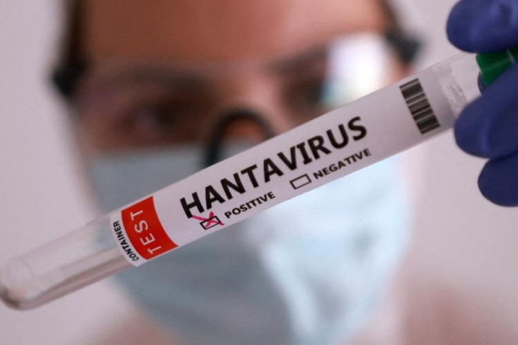 Gejala Hantavirus di Indonesia Berbeda dengan Kapal Pesiar MV Hondius, Cek Ciri-cirinya Disini!