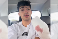 Ver video Gero Arias accidente Sin Censura el influencer que perdió dos dedos tras caer de un acantilado