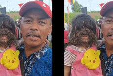 Mengenal Missclyen yang Menderita Sindrom Manusia Serigala, Penyakit Langka Buat Wajah Penderitanya Lebat Ditumbuhi Rambut  