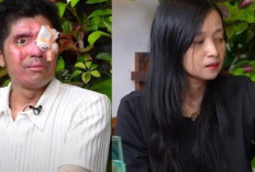 Viral! Istri Agus Salim Korban Siraman Air Keras Diduga Selewengkan Uang Donasi, Teh Novi: Ini Bukan Warisan!