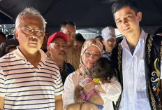 Viral Missclyen Penderita Sindrom Manusia Serigala Diadopsi Oleh Ratu Malaysia Jadi Anak Angkat 